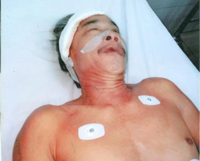 Giúp ông Quy chữa bệnh